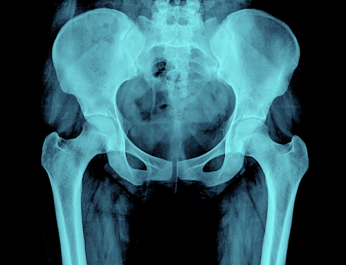 Padecimiento de rodilla